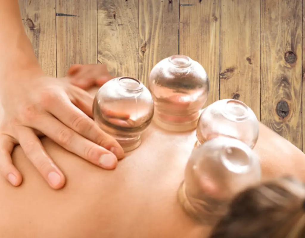 cupping